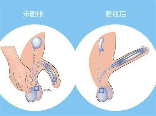 成都素美医疗美容门诊部李建钢排第几？一文揭秘他在韩国医美界的真实排名情况！ 