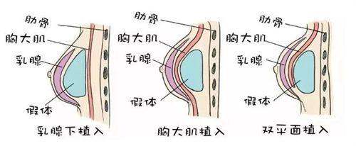 北京华臣医疗美容门诊部在哪个位置？告诉你具体地址，还有他家热门医美项目介绍！ 
