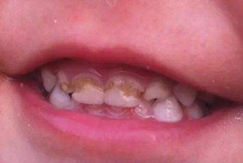 深圳美莱口腔门诊部患者体验如何?真实评价见分晓