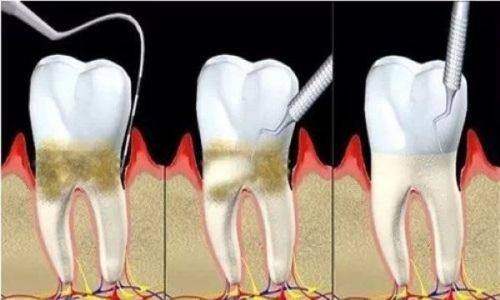 南通中諾口腔醫院是什麼檔次的醫院？