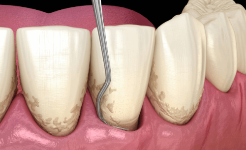 南通中诺口腔医院的处罚情况说明