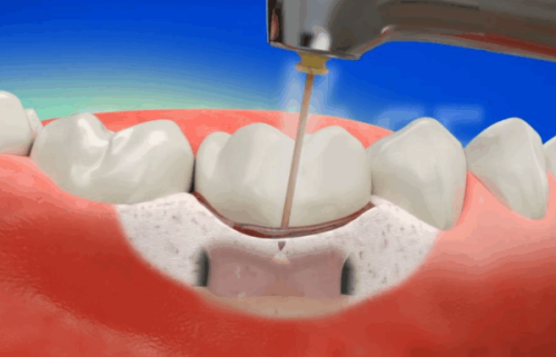 深圳美莱口腔门诊部：2021整形价格表