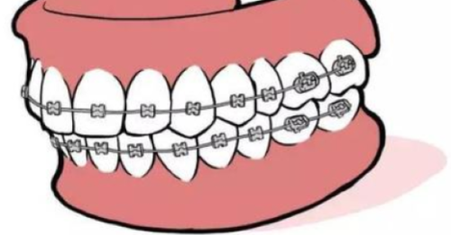 濟南百年中牙口腔醫院是莆田系醫院嗎？一文揭秘其背景，讓你清楚就診選擇！ 
