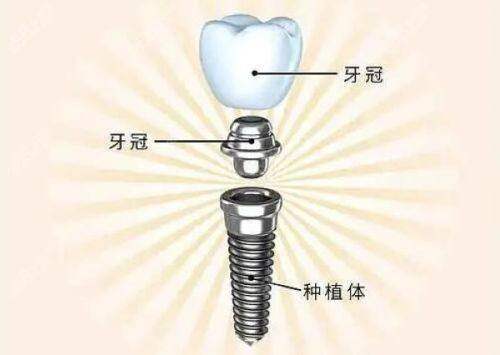 美牙市場亂象，正規口腔門診的優勢