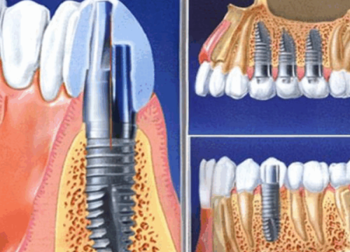 美萊實力口腔醫生團隊：精英薈萃