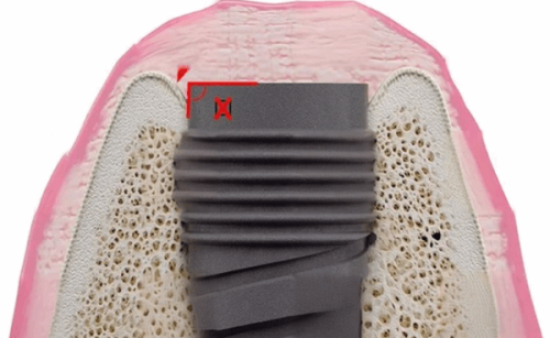 九江楠山口腔門診部是正規的嗎？放心！他家醫資硬、設備新，看牙有保障！ 