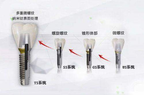 北京泰康拜博企业管理有限公司国贸口腔门诊部：如何选择适合自己的医生