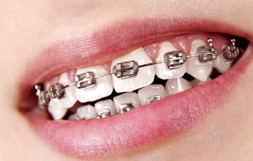 呼和浩特天牙口腔門診部口碑情況