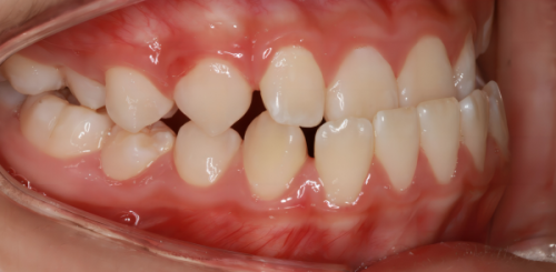 公交出行攻略的重要性