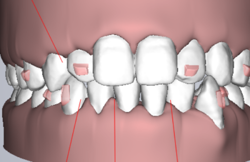 呼和浩特天牙口腔門診部收費標準