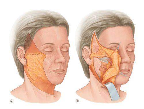 成都素美医疗美容门诊部的热门眼部整形项目优势