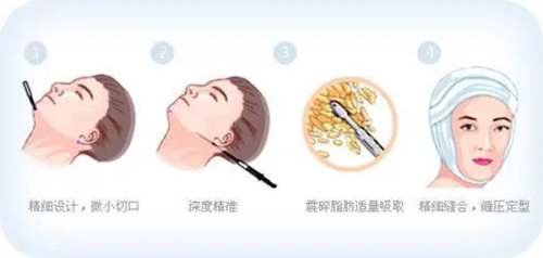 不同地铁站到北京华臣医疗美容门诊部的具体路线攻略