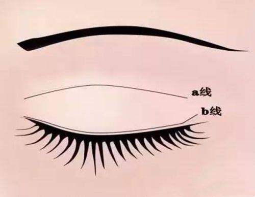 多样医美项目：满足多元需求