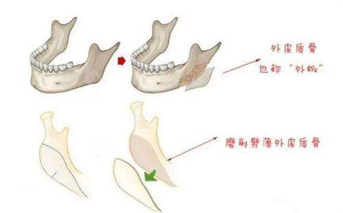 到达北京华臣医疗美容门诊部后的温馨提示
