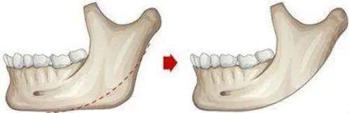绍兴维美美容医院收费贵吗？给你讲讲业内行情，看完你就心里有数了！ 