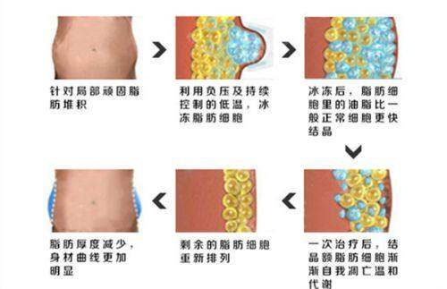 成都素美医疗美容门诊部值得信赖吗？技术靠谱医生专业，术后效果好口碑佳值得选