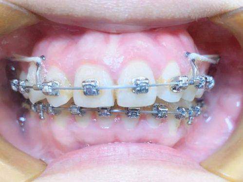 呼和浩特天牙口腔診所的環境與服務如何？