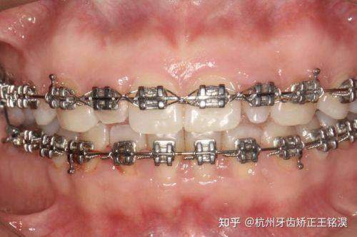 呼和浩特天牙口腔診所的收費標準怎樣？