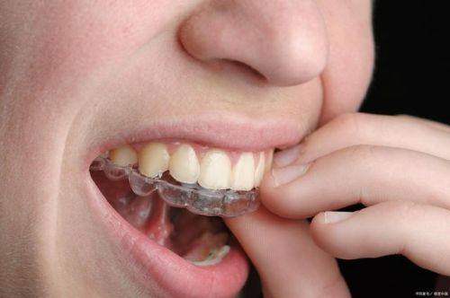 呼和浩特天牙口腔診所陳振華金屬托槽矯正可信嗎？確實靠譜，口碑技術都值得信賴！ 