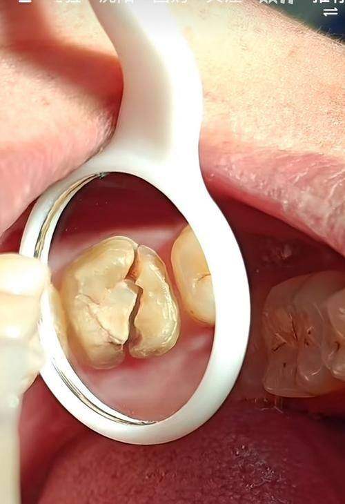 呼和浩特天牙口腔醫院收費標準