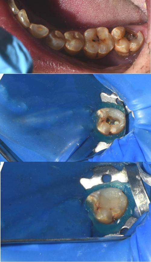 呼和浩特天牙口腔醫院真實实例見證技術靠譜