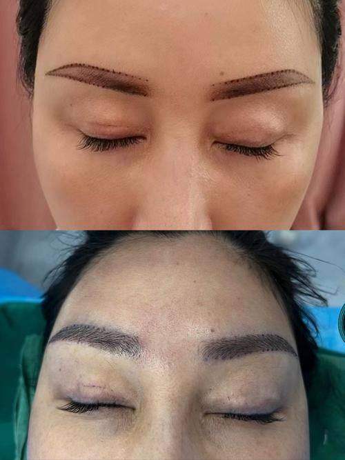 郑州曙光植发中 心综合评估