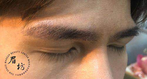 郑州曙光植发汪正伟眉毛种植能相信吗？医生经验丰富技术好，效果有保障可放心！ 