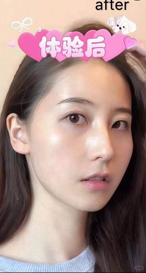 绍兴维美美容医院水光补水的优势亮点