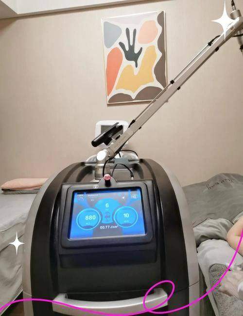 绍兴维美美容医院皮秒激光实例一:色斑女孩的逆袭