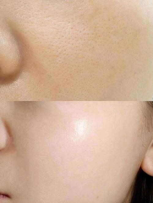 绍兴维美美容医院在绍兴市做水光针很有名吗？没错，技术口碑双优，深受当地爱美人士青睐 