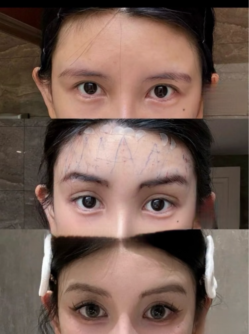 真实实例见证郑州曙光植发的实力