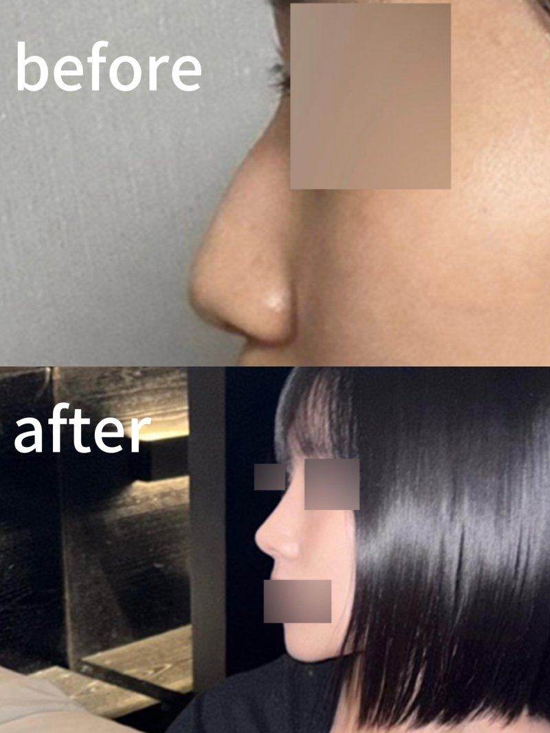 想知道确切排名?在线询问了解!