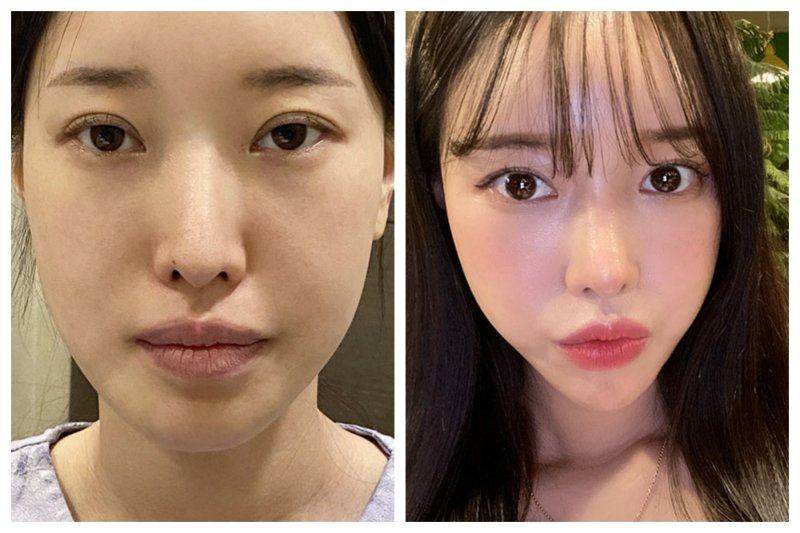 深入了解李建钢医生的医美实例