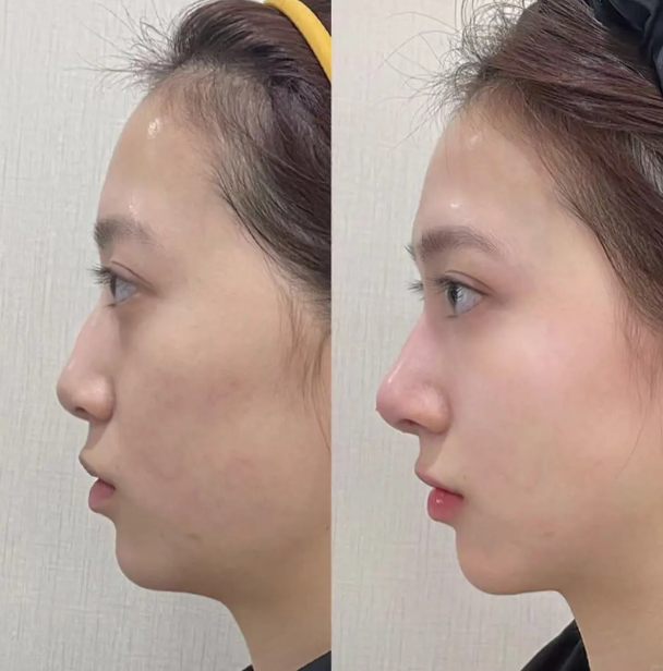 郑州曙光植发的技术特色与优势