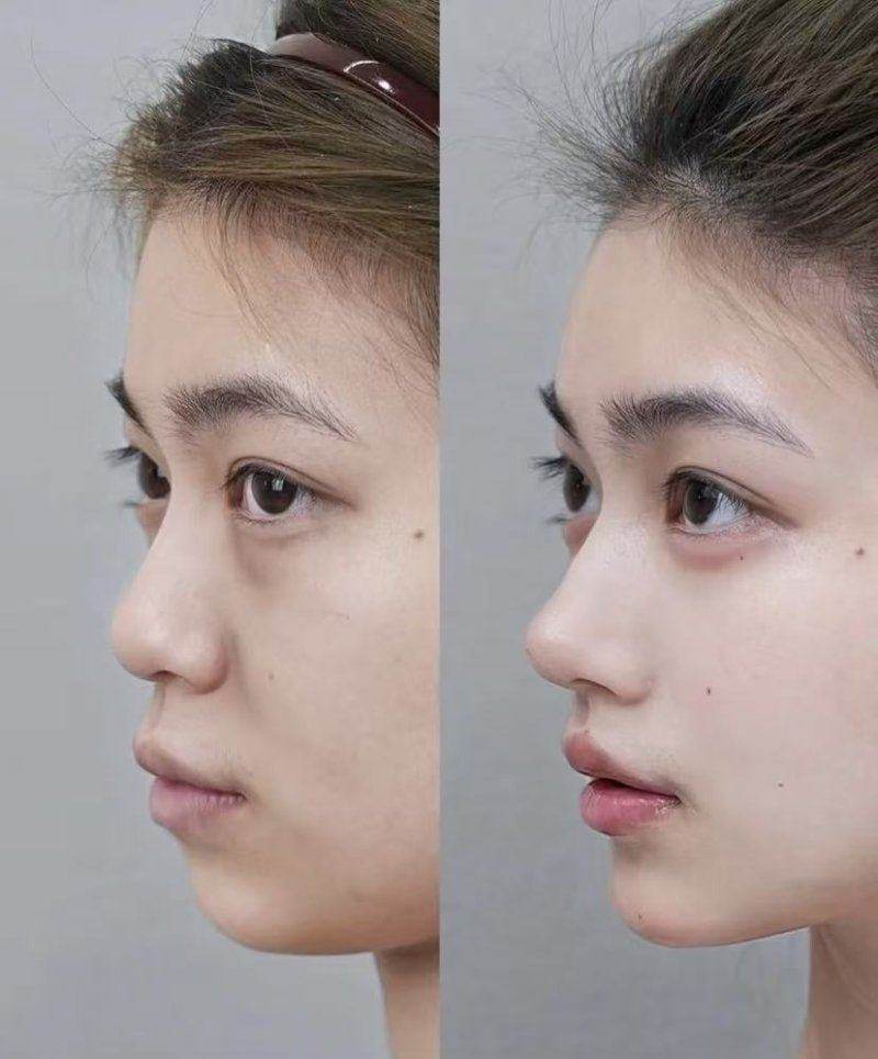 郑州曙光植发的技术实力