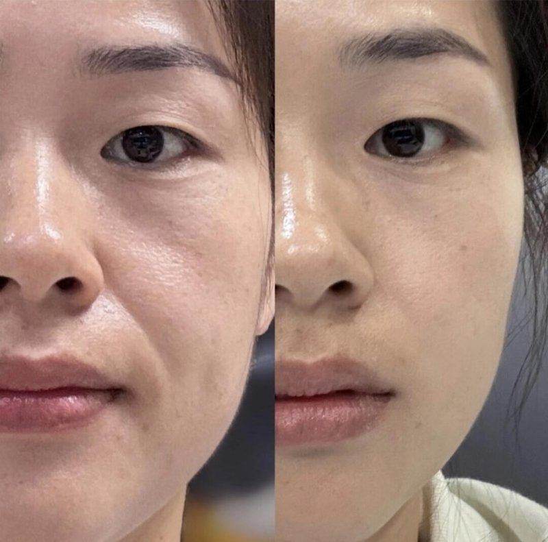 郑州曙光植发：真实实例见证奇迹