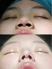 成都素美医疗美容门诊部：收费标准透明合理