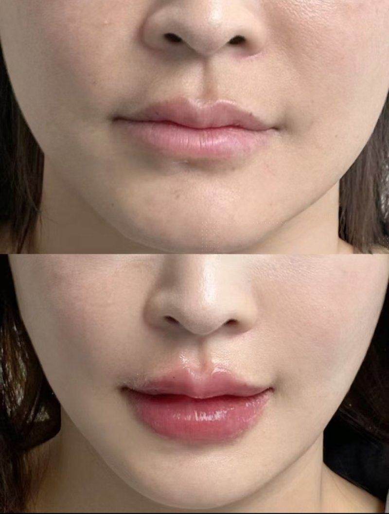 郑州曙光植发价格影响因素及选择建议