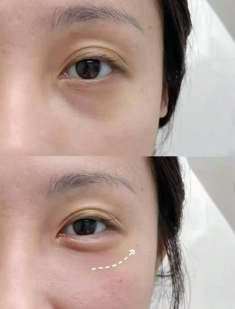 成都武侯素美医疗美容门诊部李建钢医生口碑实证：患者眼中的“超赞”体验