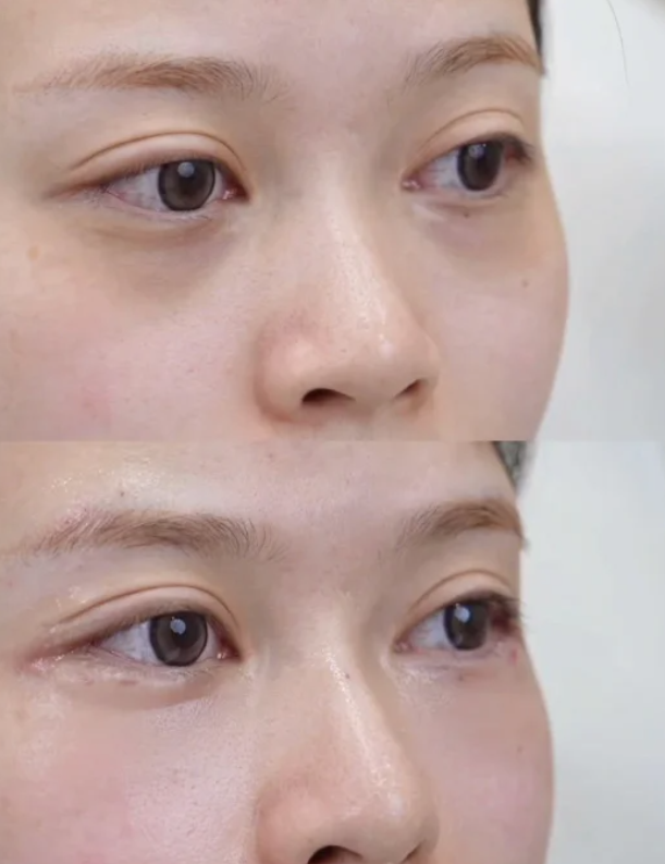 大连爱德丽格医疗美容门诊部是莆田系医院吗？权威解答，带你了解其真实背景！ 