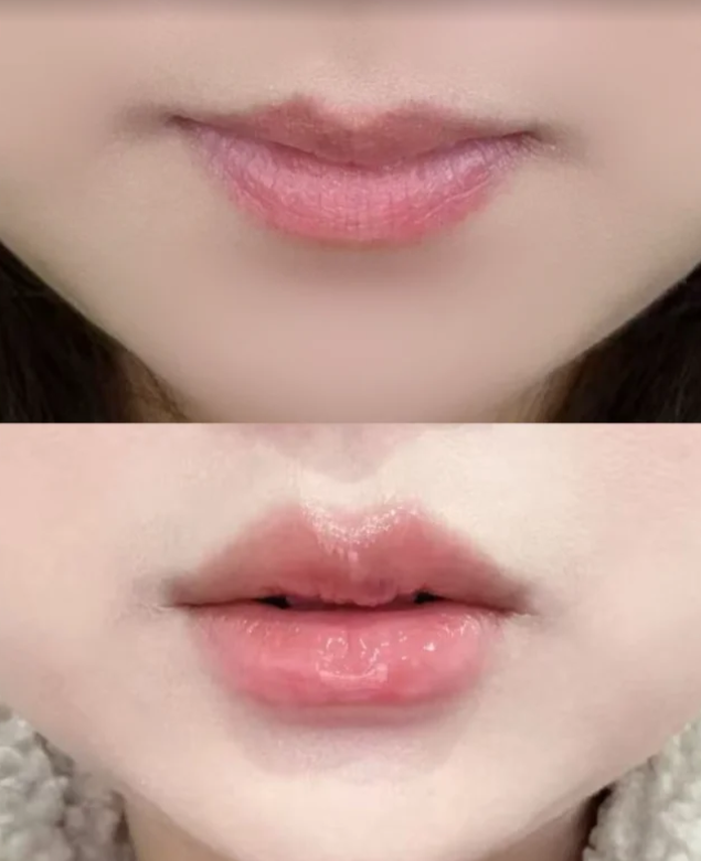 绍兴维美美容医院热门项目收费分析