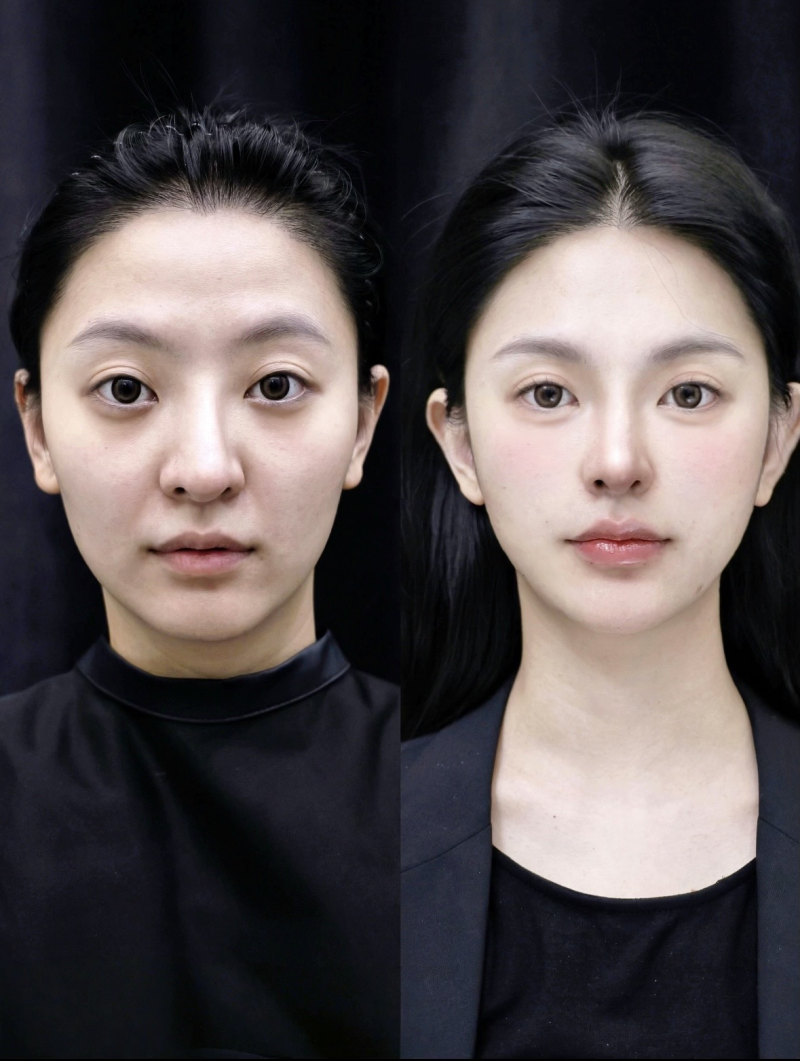 北京华臣医疗美容门诊部周边地铁出行的贴心小提示