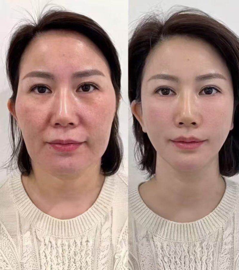 乘坐地铁前往北京华臣医疗美容门诊部的路线指引