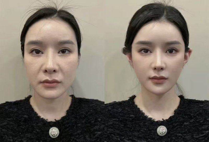 专精医美团队：实力铸就品质