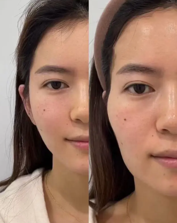 郑州曙光植发医疗美容门诊部过往价格及技术特色回顾