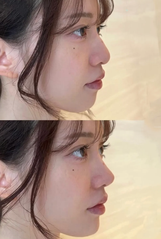 成都素美医疗美容门诊部李建钢排第几？为你揭秘他在成都医美界的真实排名情况！ 