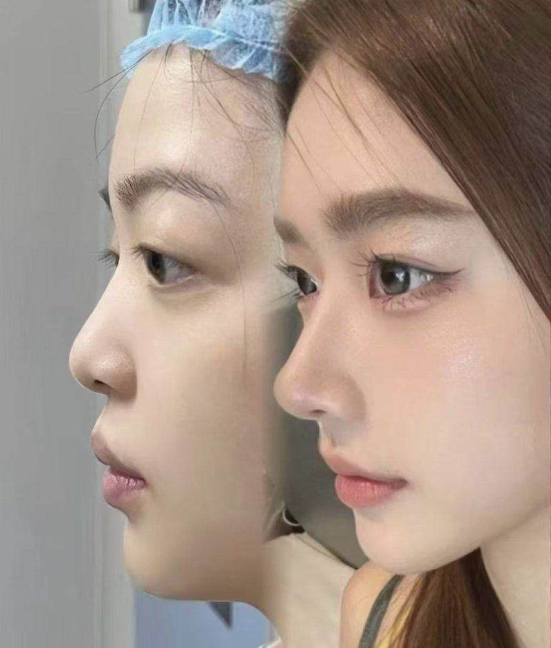 绍兴维美美容医院的价格参考