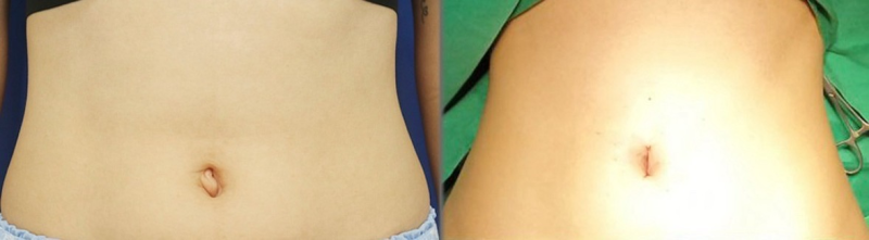 成都素美医疗美容门诊部的热门皮肤美容项目优势