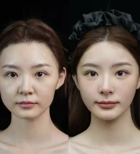 郑州曙光植发值得信赖吗？看看真实案例和患者评价，答案超有说服力！ 