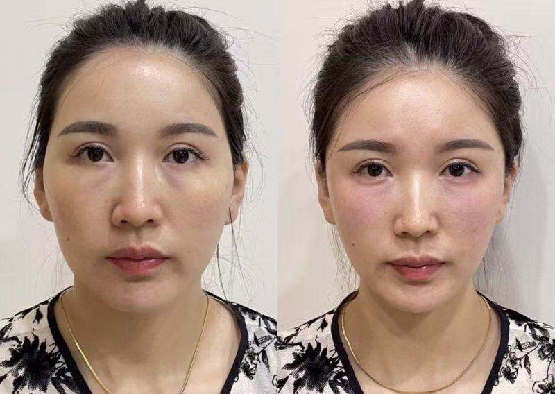 北京华臣医疗美容门诊部在哪个地铁站下？一文给你说清便捷抵达的地铁站点！ 